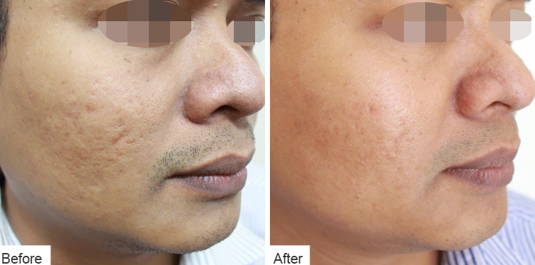 Divine Facelift - Before & After